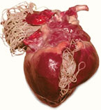 Understanding Heartworm Disease